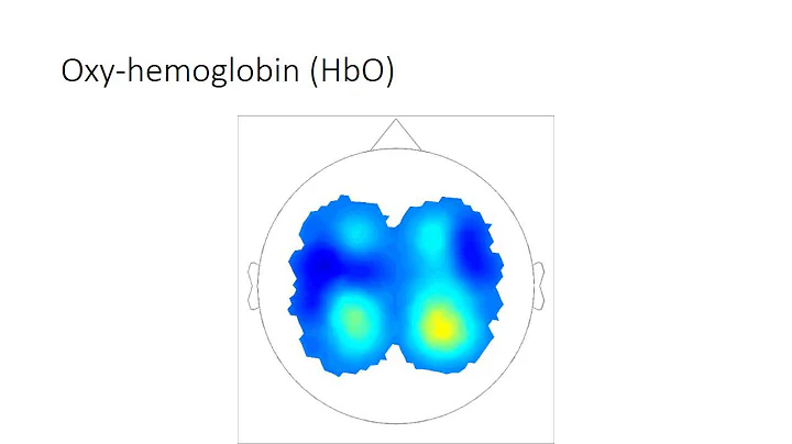 NIRx Overview -  fNIRS Imaging Systems and Software Presentation
