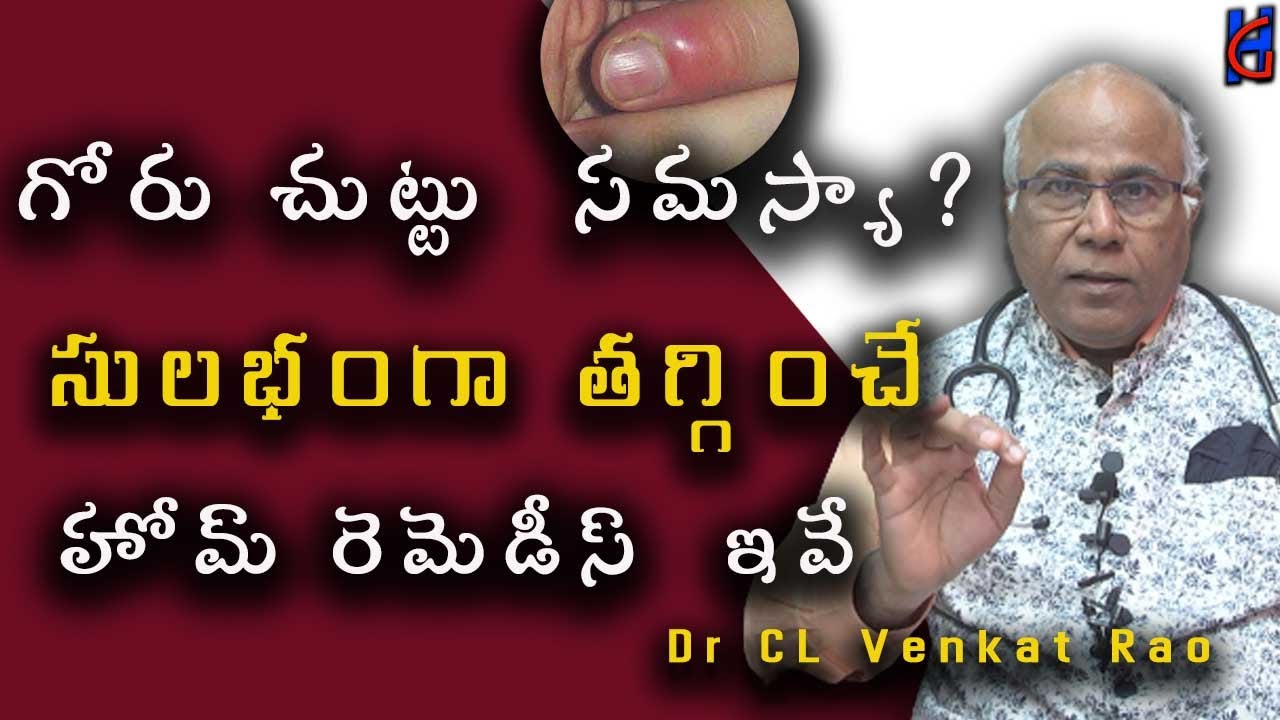 Goru Chuttu Home Remedies | Nail Infection Treatment at Home | Paronychia | Dr CL Venkat Rao