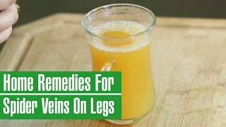 How To Get Rid Of SPIDER & VARICOSE Veins On Legs Naturally With Home Remedies