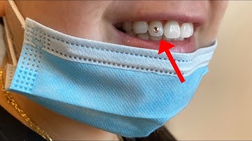 TOOTH GEM | STEP BY STEP TUTORIAL