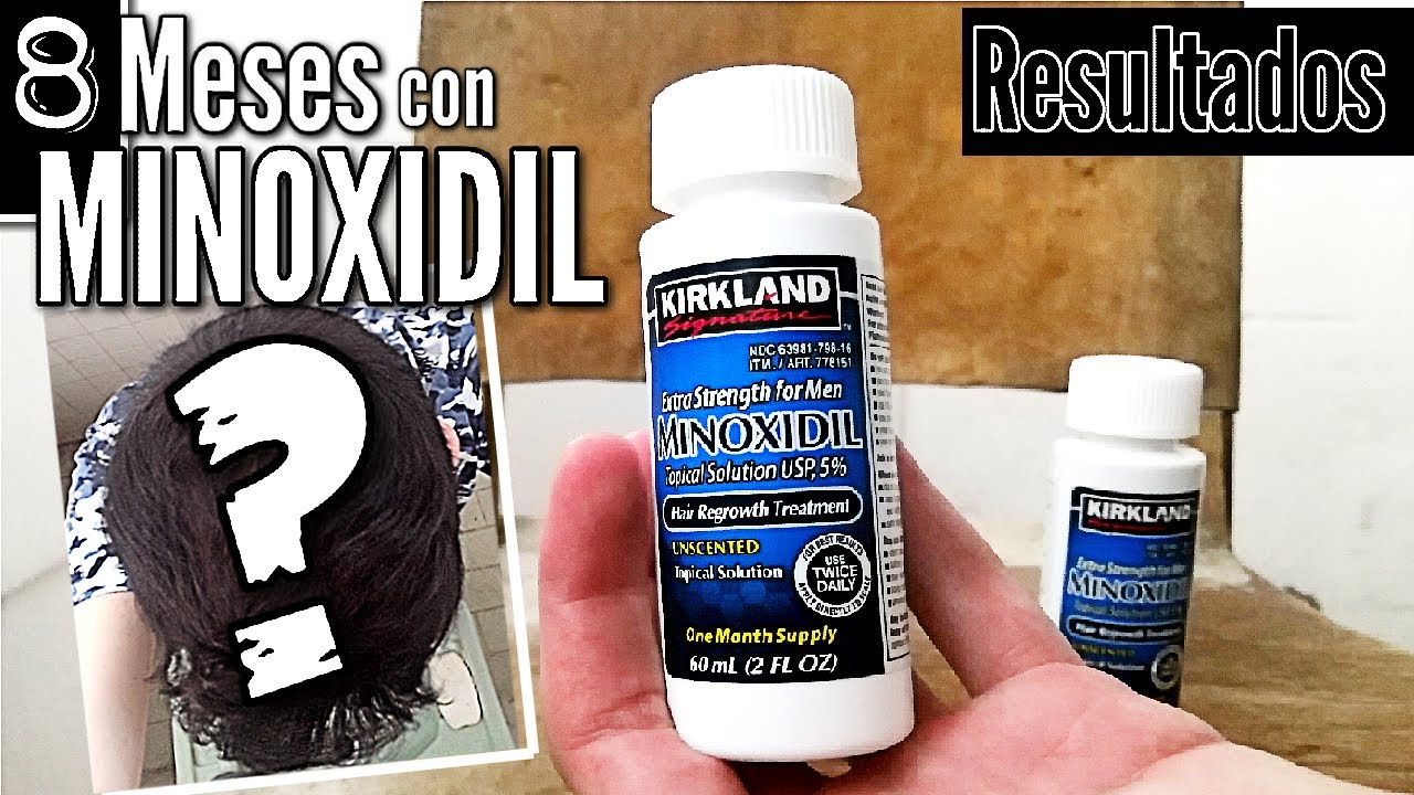 Como funciona el minoxidil