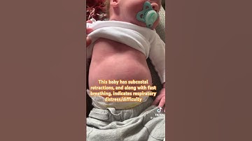 Thumbnail of Fast breathing in baby | Breathing difficulty | Chest retractions