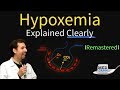 Hypoxemia - The 5 Causes & Treatment... #1 High Altitude