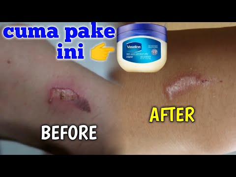 Video: Vaseline - Arahan Untuk Menggunakan Salap, Ulasan, Harga, Komposisi, Analog