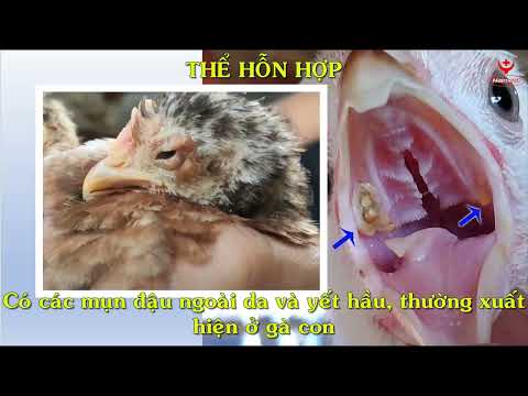 Video: 3 cách để chữa bệnh viêm thực quản