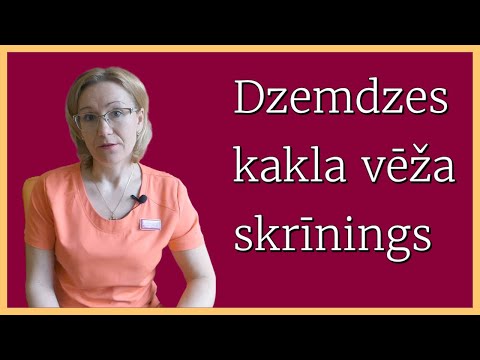 Video: Kā paplašināt dzemdes kaklu: 7 soļi (ar attēliem)