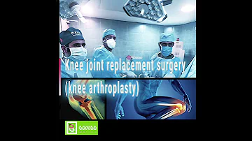 Knee Joint Replacement Surgery Knee Arthroplasty In Iran Shiraz 