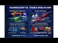 Magnetic Particle Inspection Explained | How MPI Detects Hidden Cracks & Saves Lives