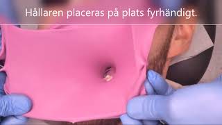 Applicering Av Kofferdam På Molar