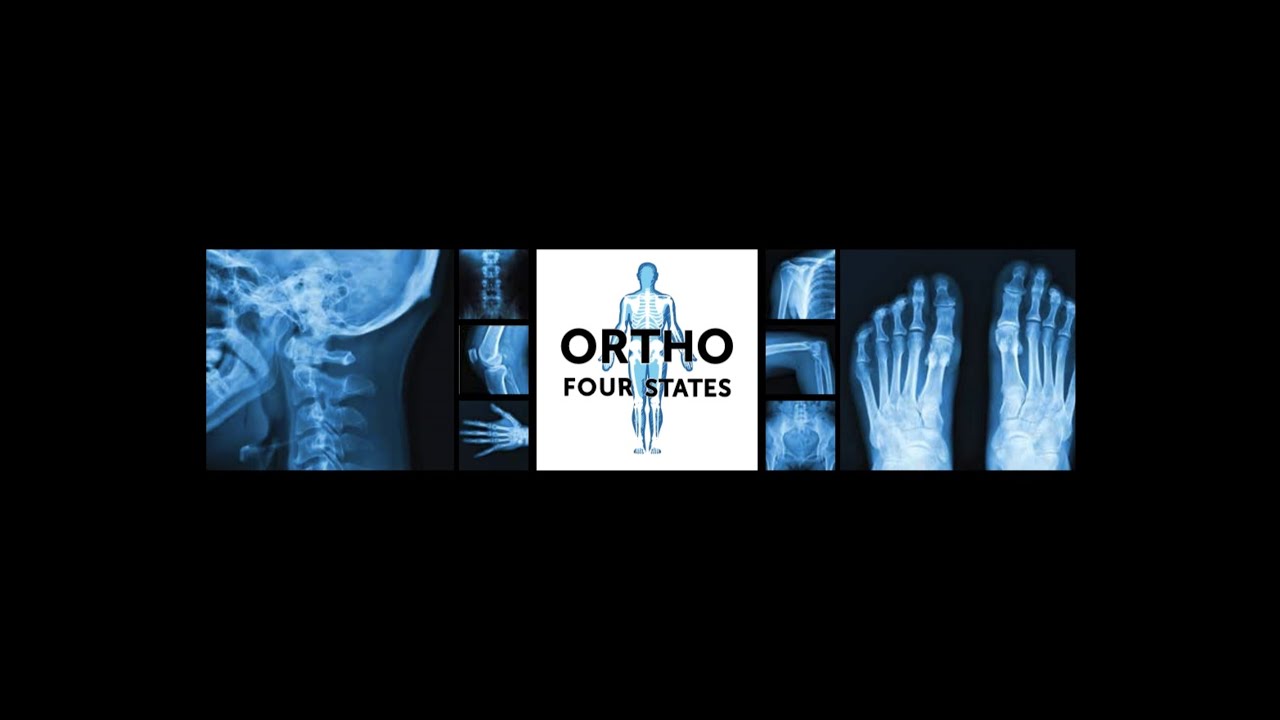 ON A MISSION TO RESTORE PATIENTS' QUALITY OF LIFE Ortho Four States