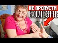 Просто посмотрите на РУКИ. Можно узнать о своей Болезни Раньше Врачей!