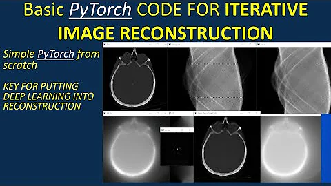 Simple PyTorch code to put deep learning into iterative image reconstruction (embeds a CNN in MLEM)