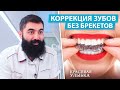 Элайнеры — когда и для чего применяют | Выравнивание зубов