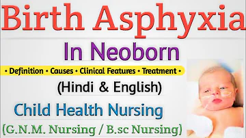 Birth Asphyxia In Newborn In Hindi