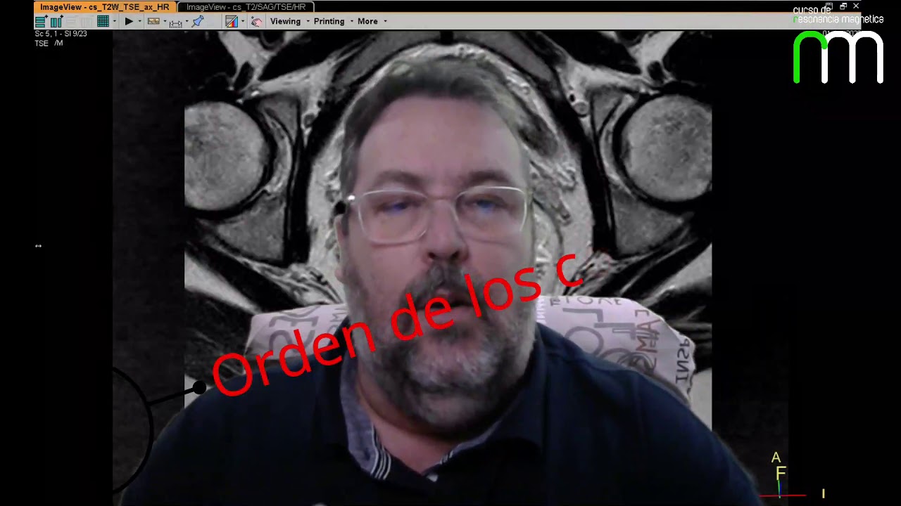 Programación de recto