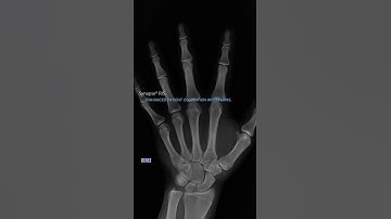 Synapse® RIS: More Streamlined Processes for Enhanced Efficiency and Modern Patient Experiences