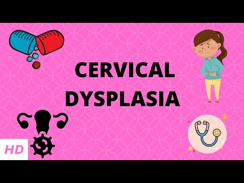 Video: Hur man behandlar grad 1 cervikal dysplasi och vad det är