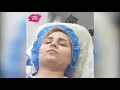 رفع غبغب با مزوتراپی رفع غبغب با مزوتراپی