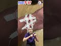 内出血を早く治す方法　#Shorts