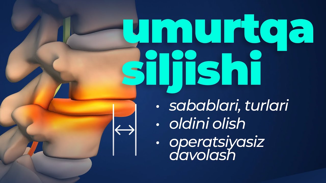 Umurtqa siljishiga vaqtida chora ko'rilmasa nima bo'ladi? | Spondilolistez | Dr. Akmaljon