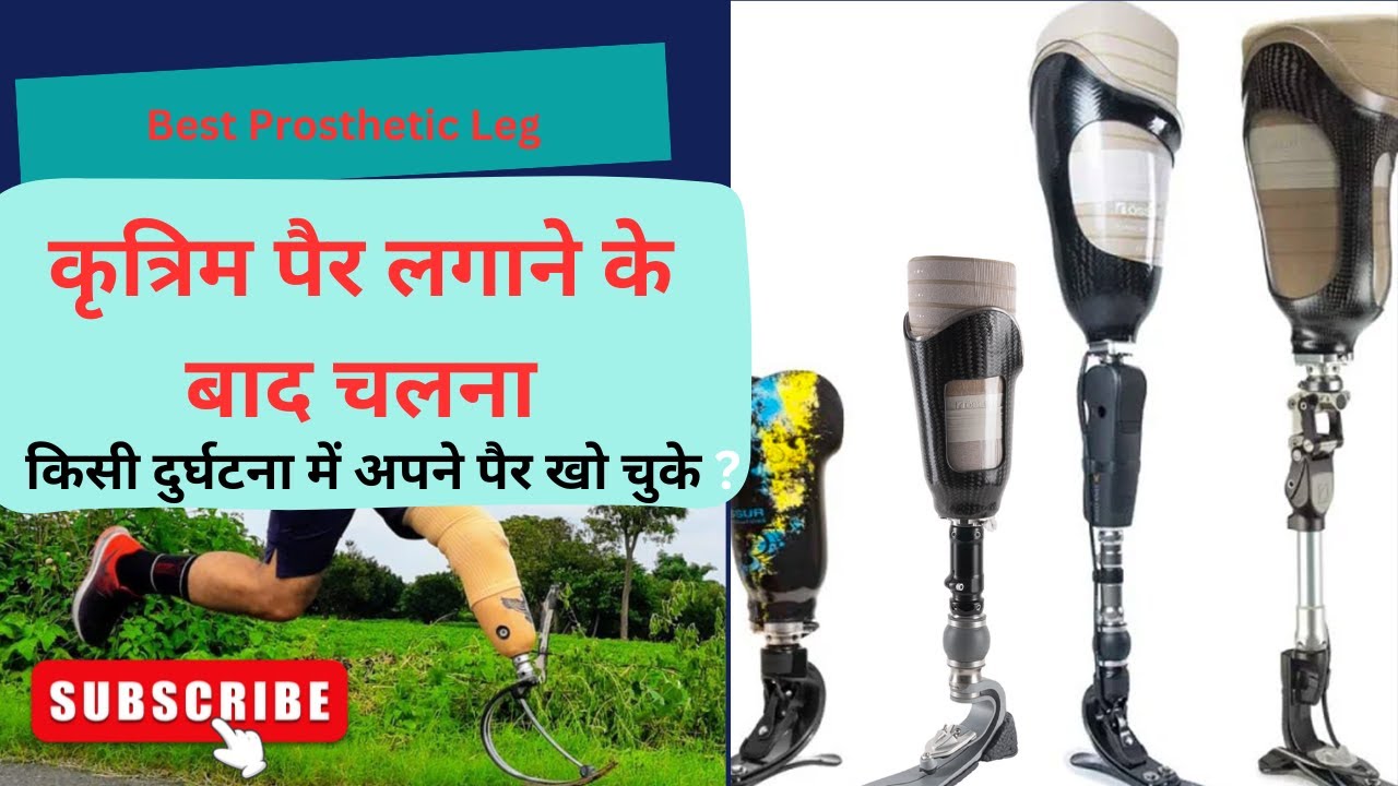 Woman Prosthetic Leg, Össur Proflex LP Align