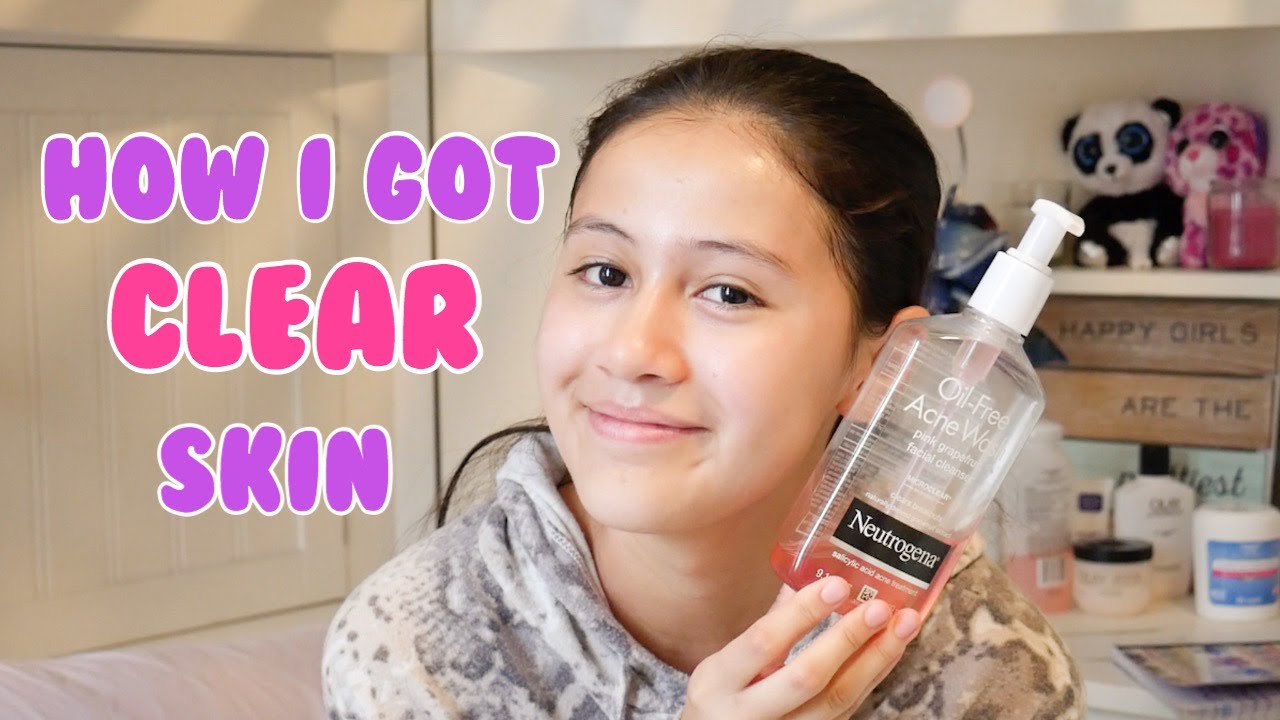 How I Got Clear Skin in a Few Weeks 2020 + My Skin Care Routine ...