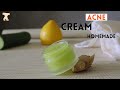 Homemade pimple cream || 100% effective acne treatment