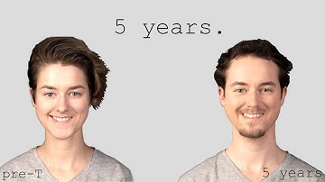 ftm: 5 years on testosterone.