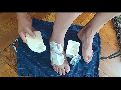 Quarkwickel bei Wasser in einer Schwellung. Quarkverband nach Prellung - YouTube