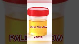 Urine Color Secrets 👀#Shorts #HealthTips #MedicalFacts #UrineColor #HealthcareAwareness