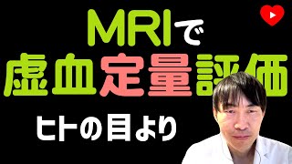 【イメージング】負荷MRIで虚血の定量評価ができる