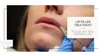 How to Easily Improve Thin Lips I Lip Filler