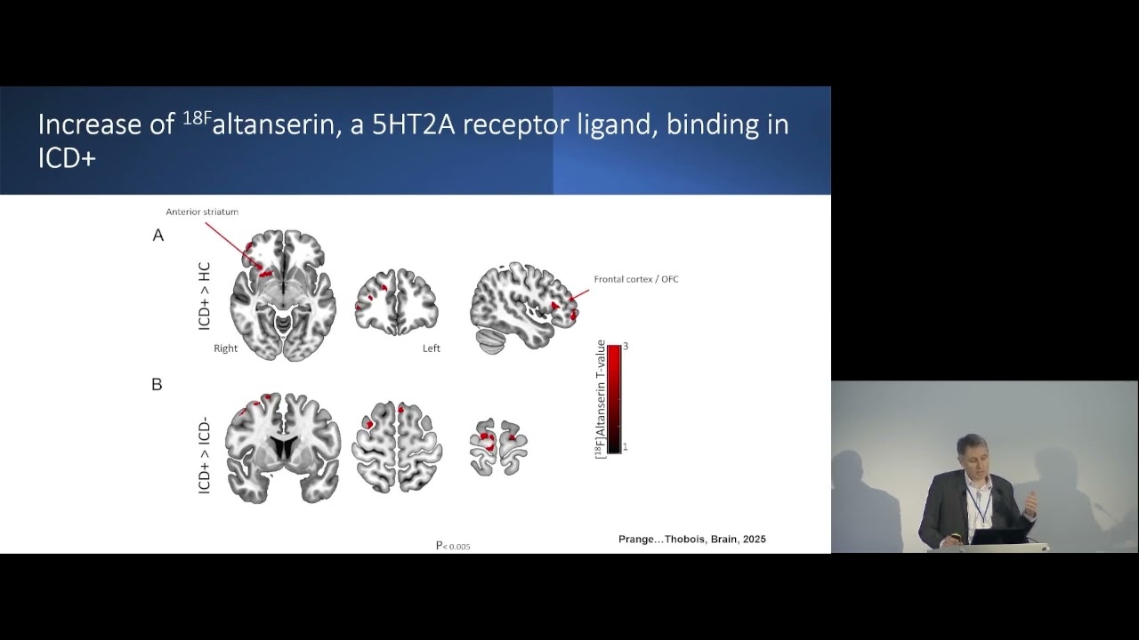 Impulse Control Disorders in Parkinson's disease - Stephane Thobois