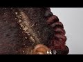 ITCHY DRY SCALP | HUGE DANDRUFF PART 1  | MY BEST SCRATCH VIDEO EVER