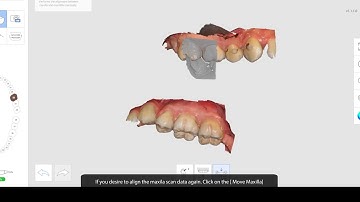 EN How to manually align the bite registration