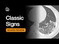 Classic signs  chest radiology board review