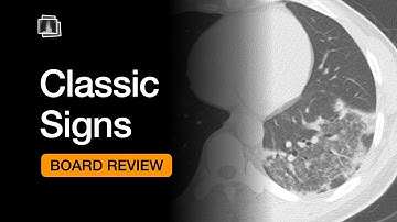 Classic Signs | Chest Radiology Board Review