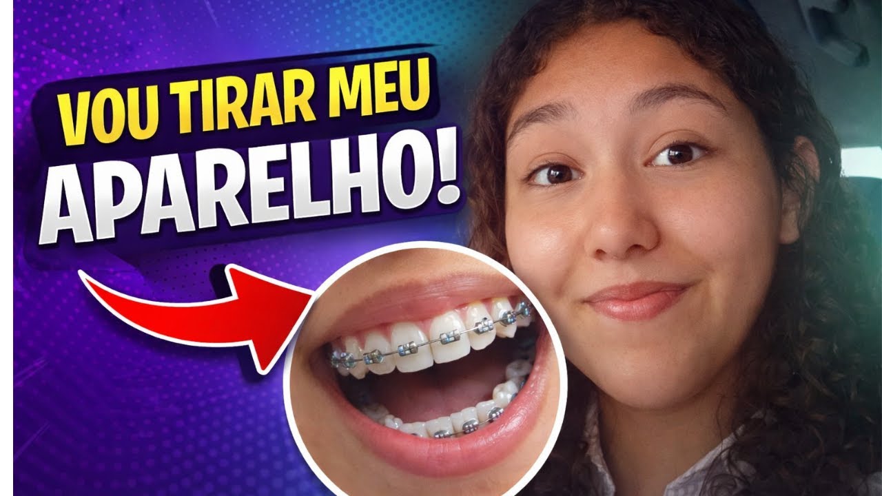 DIA DE TIRAR O APARELHO