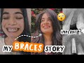 Braces in Your Twenties || Cost, Pain, Implant best kind, everything you need to know!