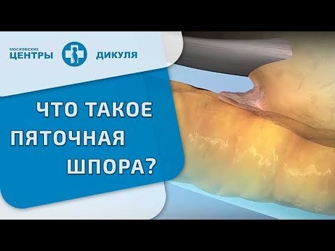 Video: Марлин шип деген эмне?