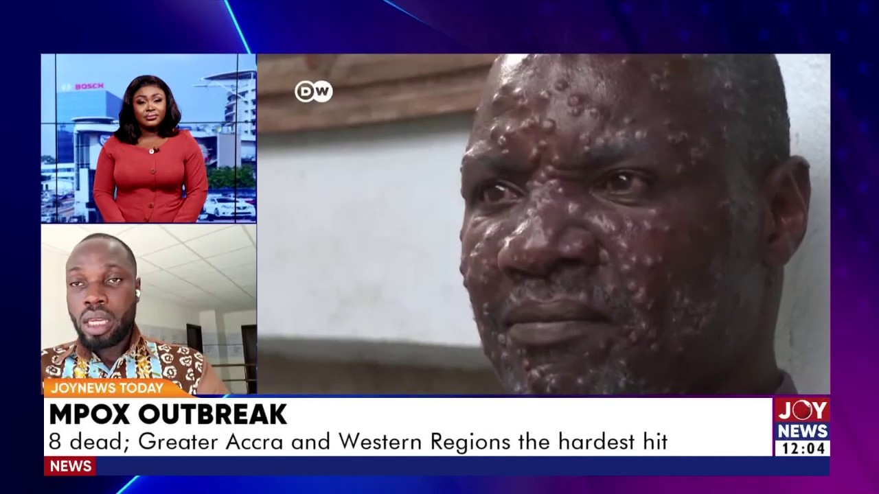 MPOX Outbreak: 8 dead; Greater Accra and Western Regions the hardest hit | JoyNews Today