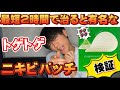 【検証】最短2時間で治るトゲトゲニキビパッチ本当に効くの？ニキビ撲滅の刃