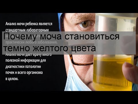 Почему моча становиться темно желтого цвета