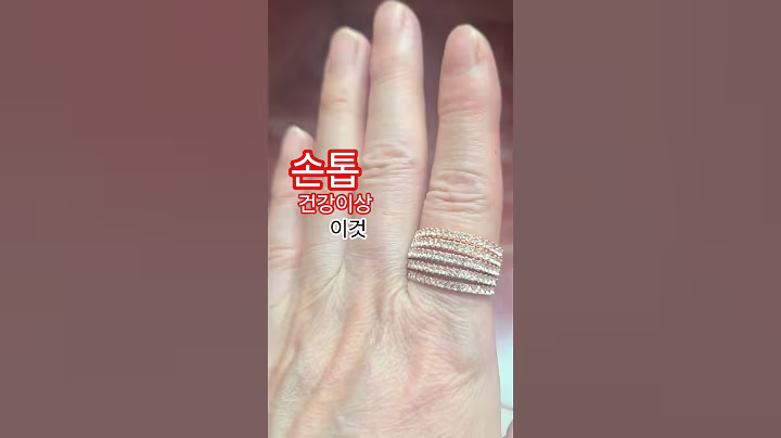 손톱에3가지보이면건강이상