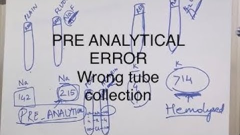 pre analytical errors/pre analytical errors laboratory/pre analytical errors in clinical chemistry