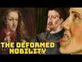 The Grotesque Jaws of the Habsburg Nobles - Habsburg Jaw