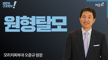 원형탈모 (모리치피부과 오준규 원장)