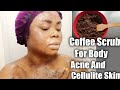 REQUESTED : How To Make Coffee Scrub For Body Acne And Cellulite skin | Bella Gold