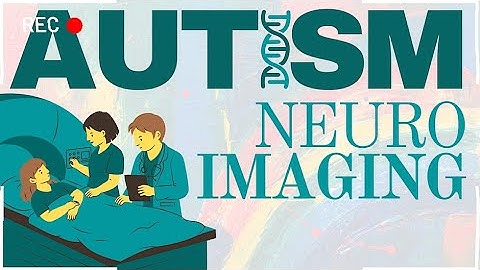 Neuroimaging in Neuroscience: Understanding Autism and Developmental Disorders