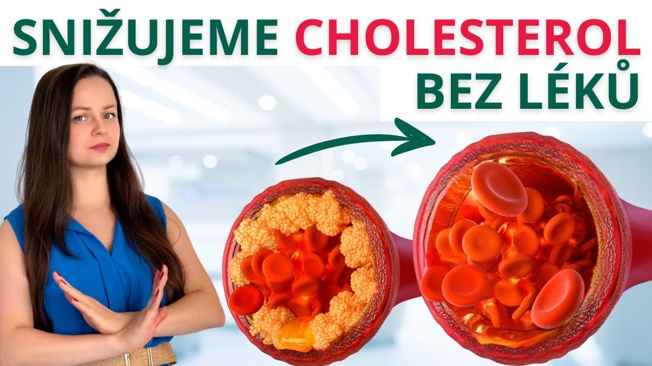 Jak snížit cholesterol BEZ LÉKŮ? / Užívání statinů / SKUTEČNÉ PŘÍČINY zvýšeného cholesterolu